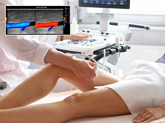 Ecografia Doppler: examinarea fluxului sanguin Ecografia Doppler: examinarea fluxului sanguin