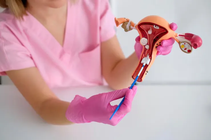 Montarea steriletului: ce trebuie să știi Montarea steriletului: ce trebuie să știi